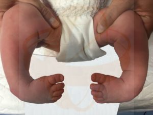 Consulta Prenatal de Ortopedia Infantil a cargo de la Dra. Laura Montes en el Centro Médico Sendagrup de Donostia - San Sebastián