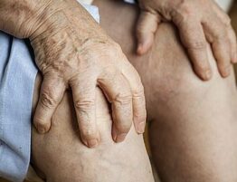 Artrosis o desgaste de rodilla dolorosa en mujer mayor