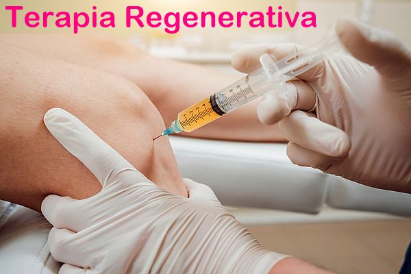 Terapia Regenerativa mediante la infiltración de Plasma Rico en Plaquetas en el tratamiento de la Artrosis de Rodilla