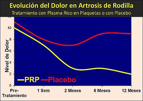 En Artrosis de Rodilla el tratamiento con Factores de Crecimiento o PRP trae consigo una disminución significativa del Dolor.